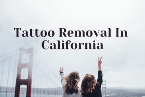 Starting a tattoo removal business in California