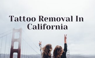 Starting a Tattoo Removal Business in California