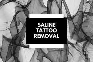 Read more about the article Saline Tattoo Removal
