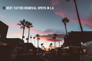 Read more about the article Best Tattoo Removal Los Angeles