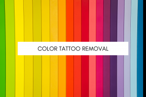 Color Tattoo Removal Article