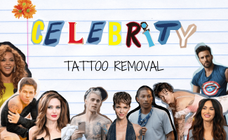 All Celebrities that got their Tattoos Removed