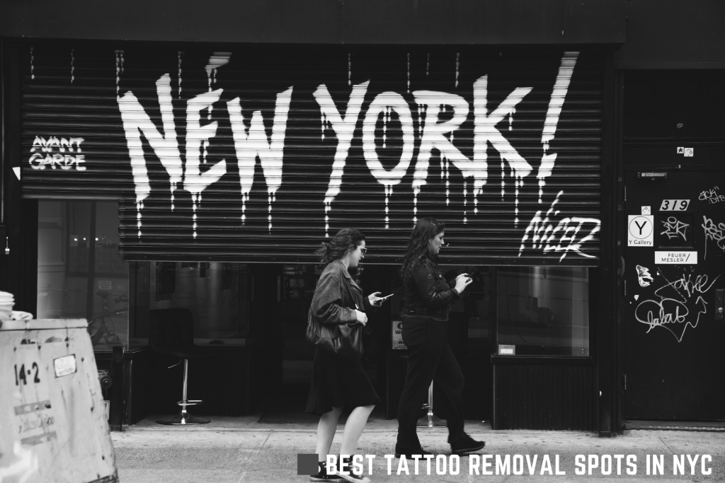 10 Best Tattoo Removal NYC – Tattoos Remove