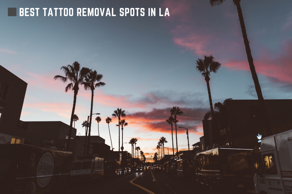 Best Tattoo Removal Spots in Los Angeles