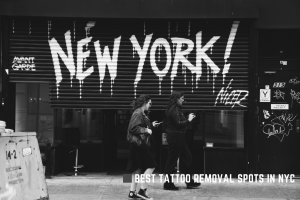 Read more about the article 10 Best Tattoo Removal NYC