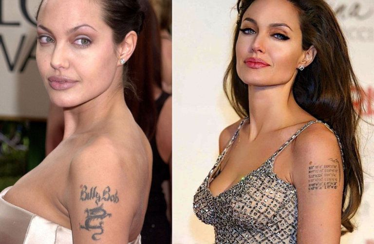 Angelina Jolie Tattoo Removal | Celebrity Tattoo Removal