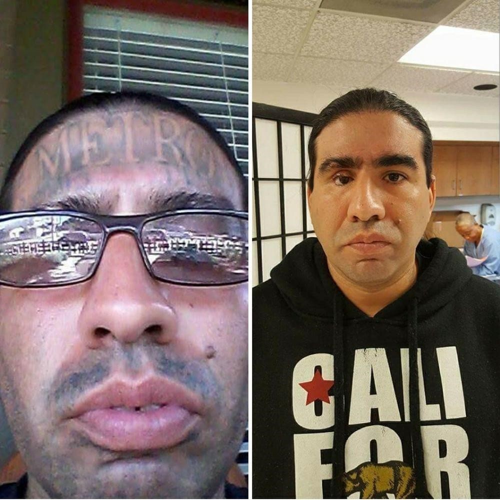 Sunrise Outreach Center Tattoo Removal Before And After