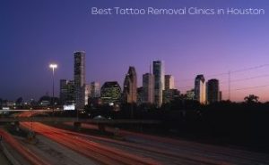 Best Tattoo Removal Clinics in Houston