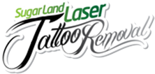 Sugarland laser Tattoo removal (Houston Area)