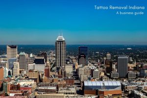 Tattoo Removal Indiana