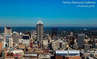 Tattoo Removal Indiana – A Business Guide