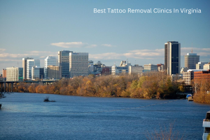Best Laser Tattoo Removal Clinics in Virginia